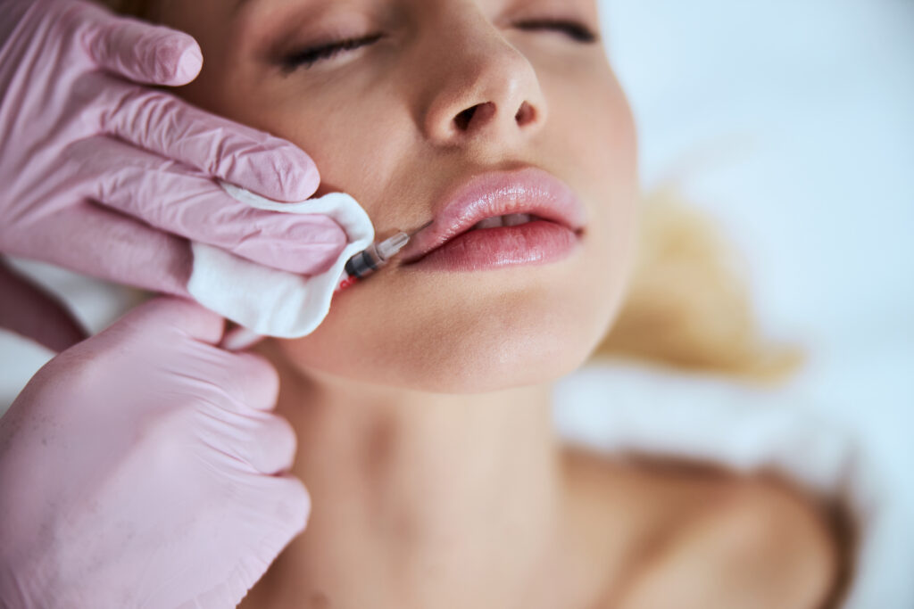 Female patient undergoing the lip enhancement procedure