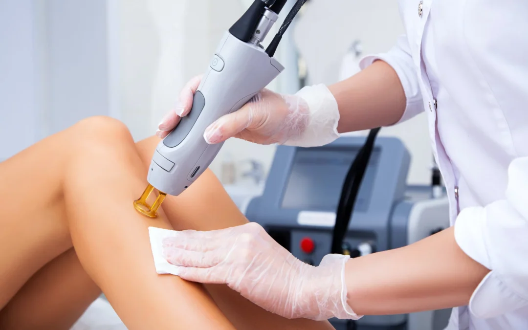 A Guide to the Laser Hair Removal Process